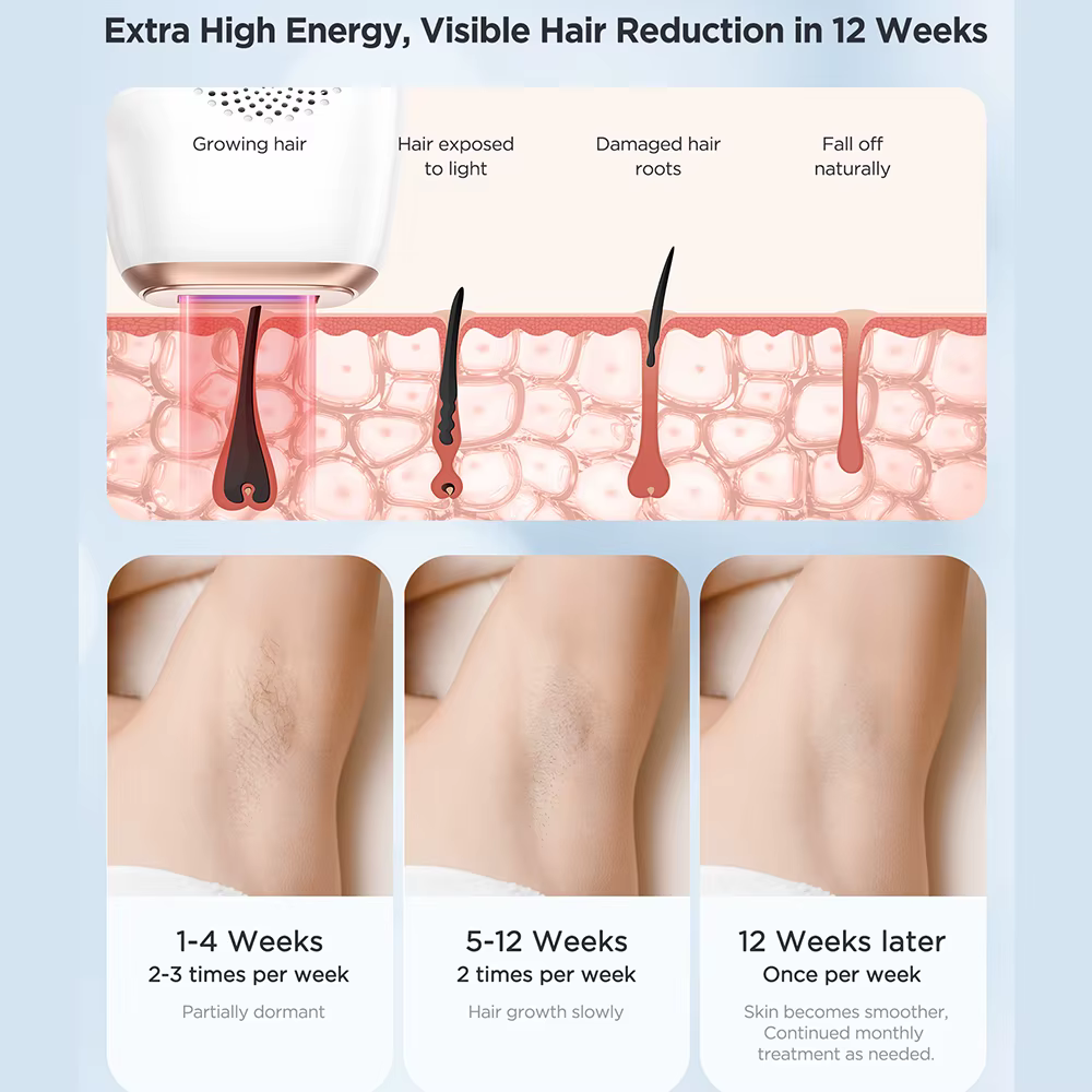 INNZA épilation au Laser avec fonction de soin de refroidissement par glace pour les femmes permanen