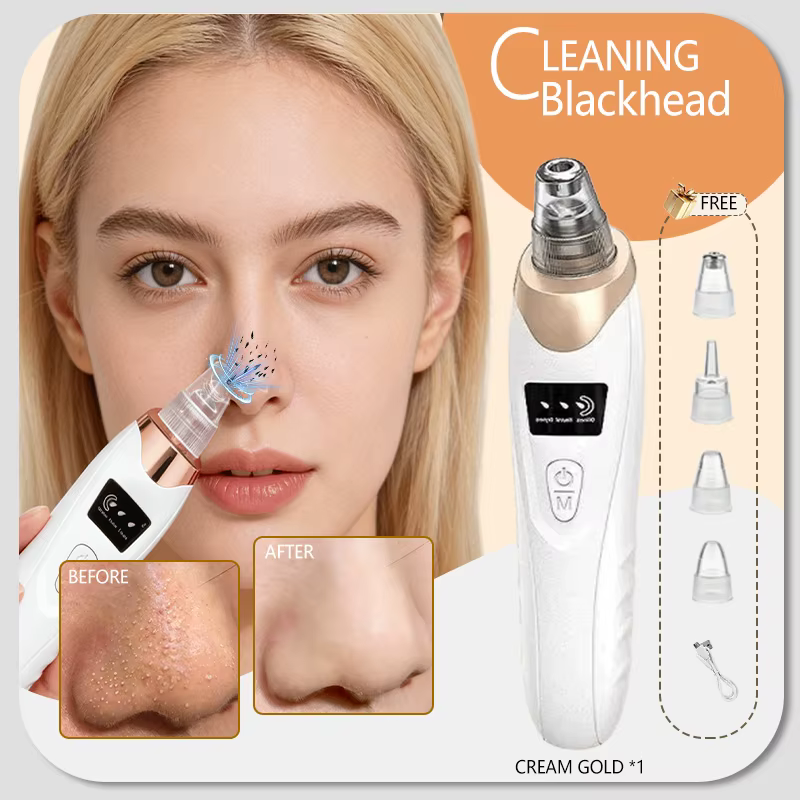Extracteur de points noirs, appareil de nettoyage de la peau du visage pour éliminer les points noir