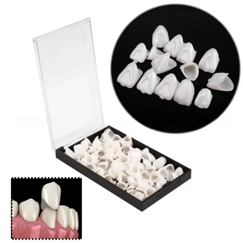 Nouveauté : 50 pièces/boîte pour soins bucco-dentaires (dents antérieures) – Facettes en porcelaine 