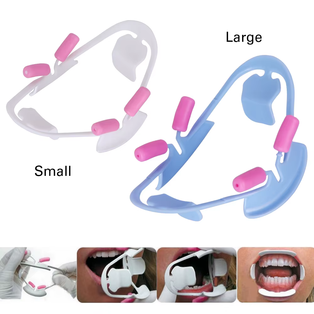 Écarteur de joues en 3D