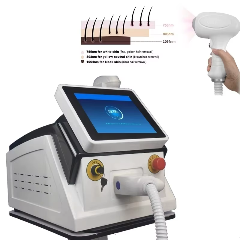 Machine d'épilation au laser à diode