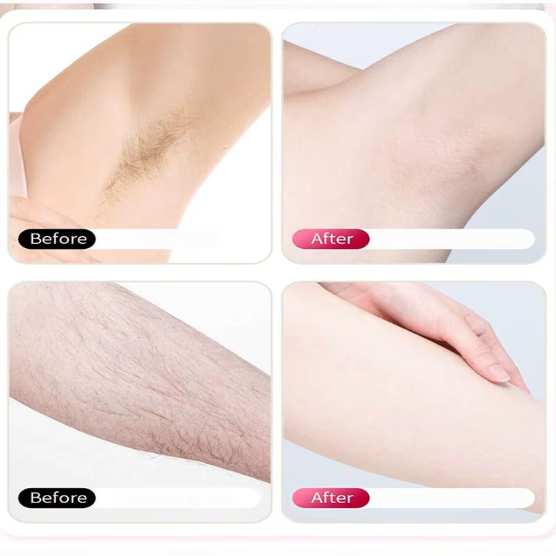 Lames de rasoir de haute qualité à 6 couches pour l'épilation du corps et du bikini des femmes