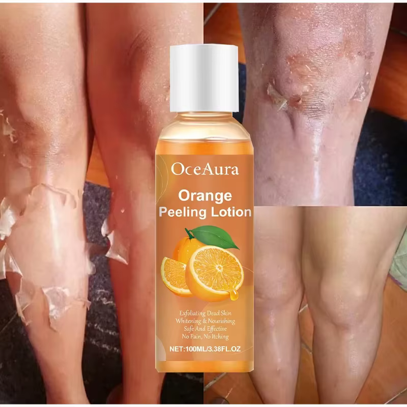 Huile exfoliante jaune, nettoyage doux, élimination des peaux mortes, sérum exfoliant pour le corps, hydratant, peau lisse et douce