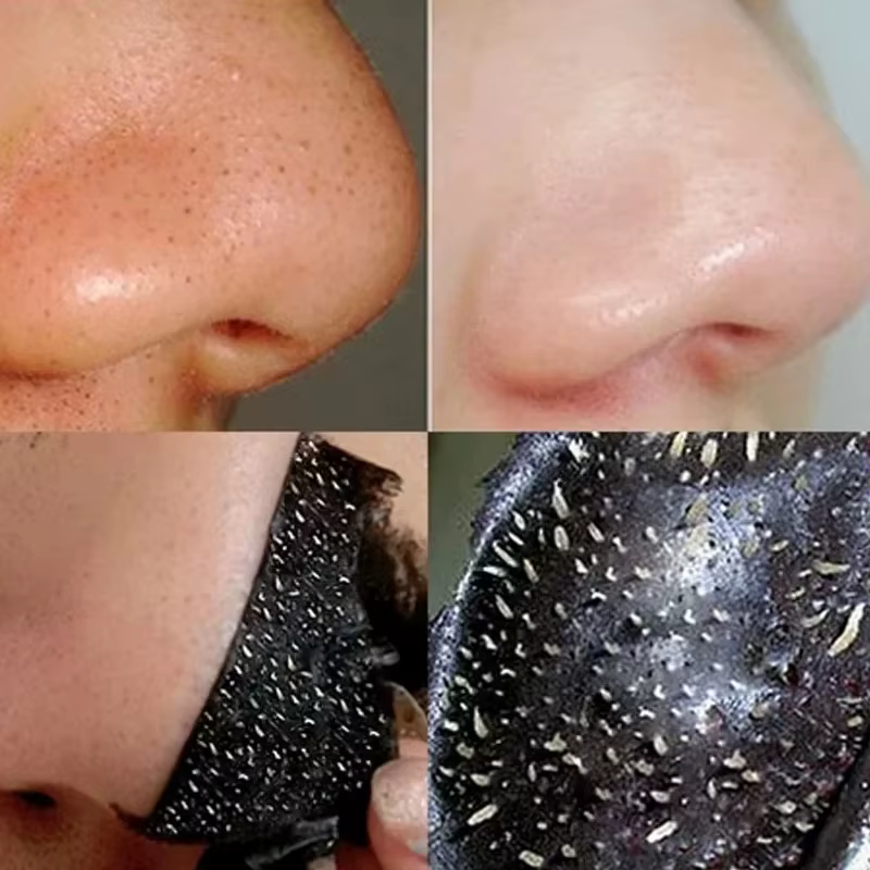 Masque anti-points noirs