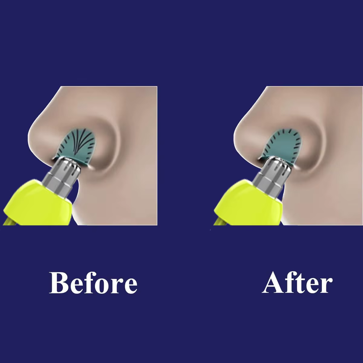 Têtes de rechange pour tondeuse à poils de nez Brangdy