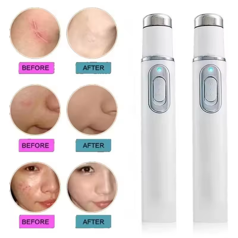Stylo Laser pour l'élimination des rides d'acné