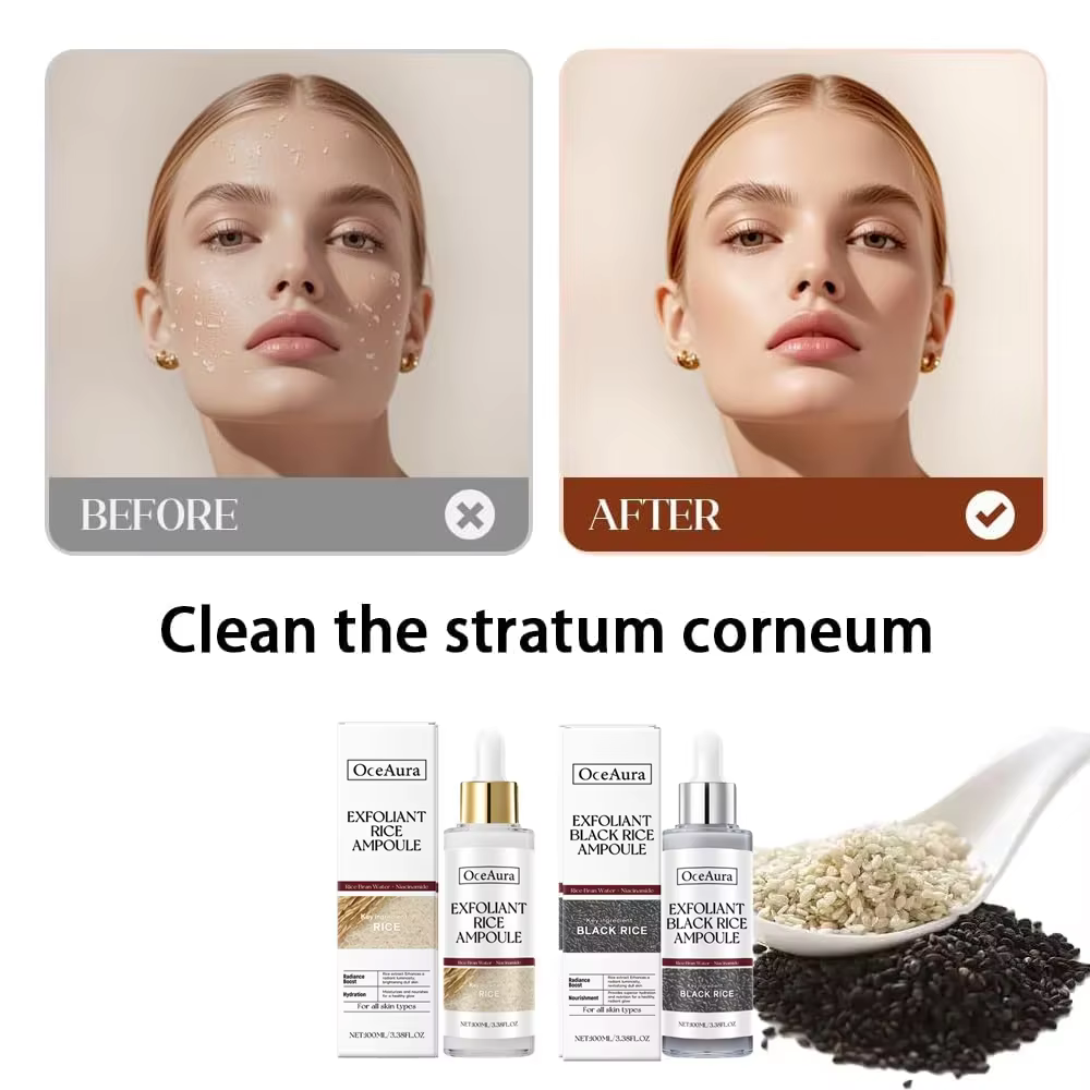 Essence exfoliante de riz noir et blanc, dissolvant de peau morte, réapprovisionnement brillant pour le visage, rétrécissement des pores, acide hyaluronique, sérum éclaircissant