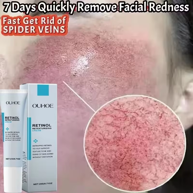 Crème réparatrice pour les rougeurs du visage