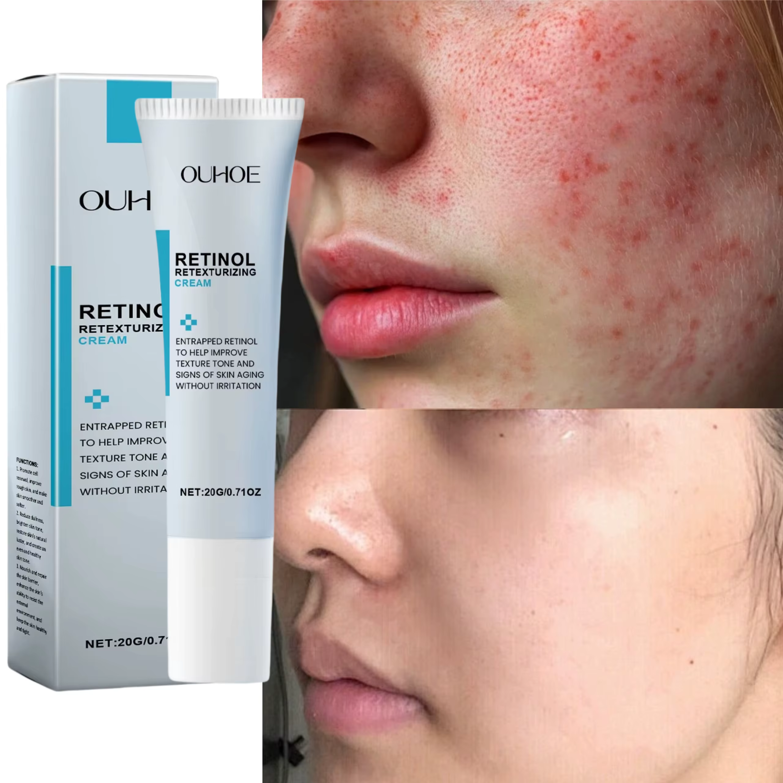 Crème réparatrice pour les rougeurs du visage