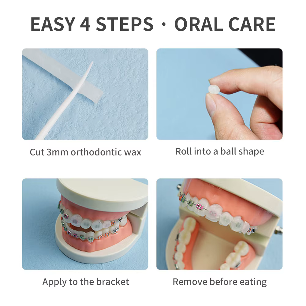 Cire de protection orthodontique, correction des dents, aromatisé aux fruits spéciaux, anti-usure, orthèses de gomme, film de support