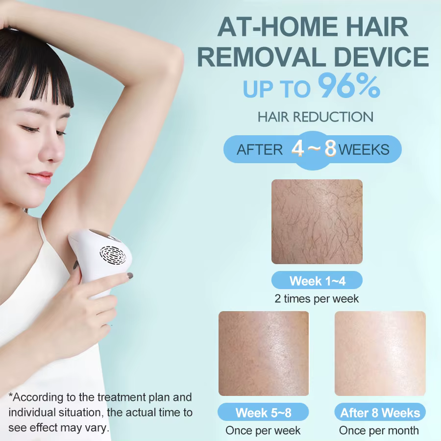 Combiné d'épilation au laser portable Vancostar 900000 Flashes Épilateur permanent indolore pour femme à la maison