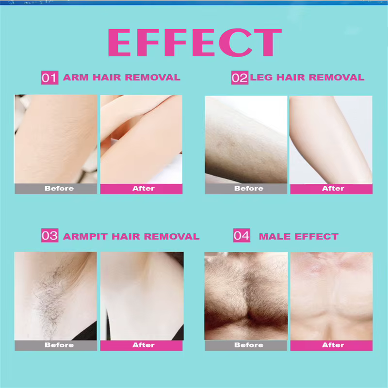 Lot de 10 bandes de cire dépilatoires en non-tissé pour le visage
