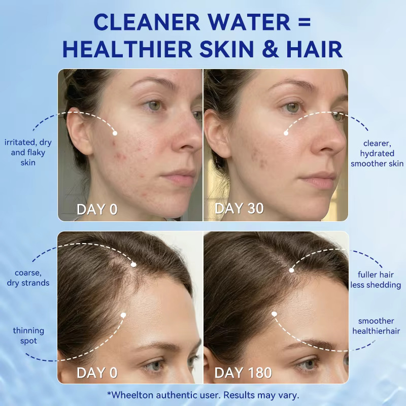 Filtre à eau pour douche domestique Wheelton - Filtre à eau qui réduit le chlore, les métaux lourds et les sédiments, améliore la peau sèche et les démangeaisons, et la perte de cheveux