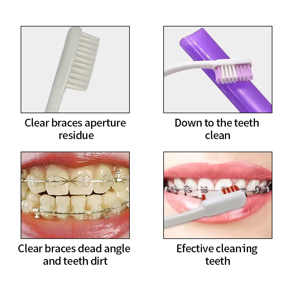 Kit de Soins Orthodontiques, Hygiène Buccale, Livres de Dents, Miroir Buccal, Brosse Interdentaire, Fil d'Avertissement, 8 Pièces/Ensemble