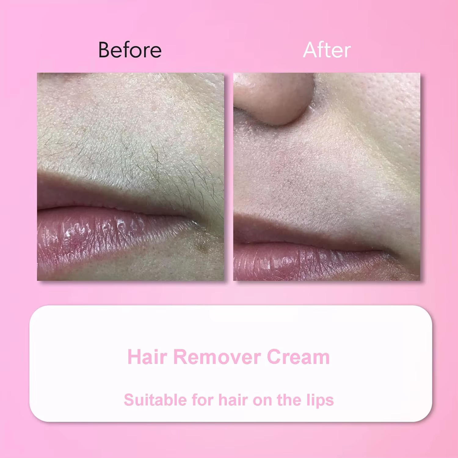 Kit de crème dépilatoire pour le visage pour femmes