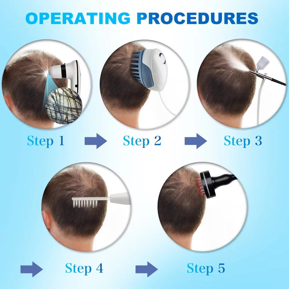 Traitement de perte de cheveux croissance 2 têtes de détecteur HD dispositif d'analyse du cuir chevelu machine