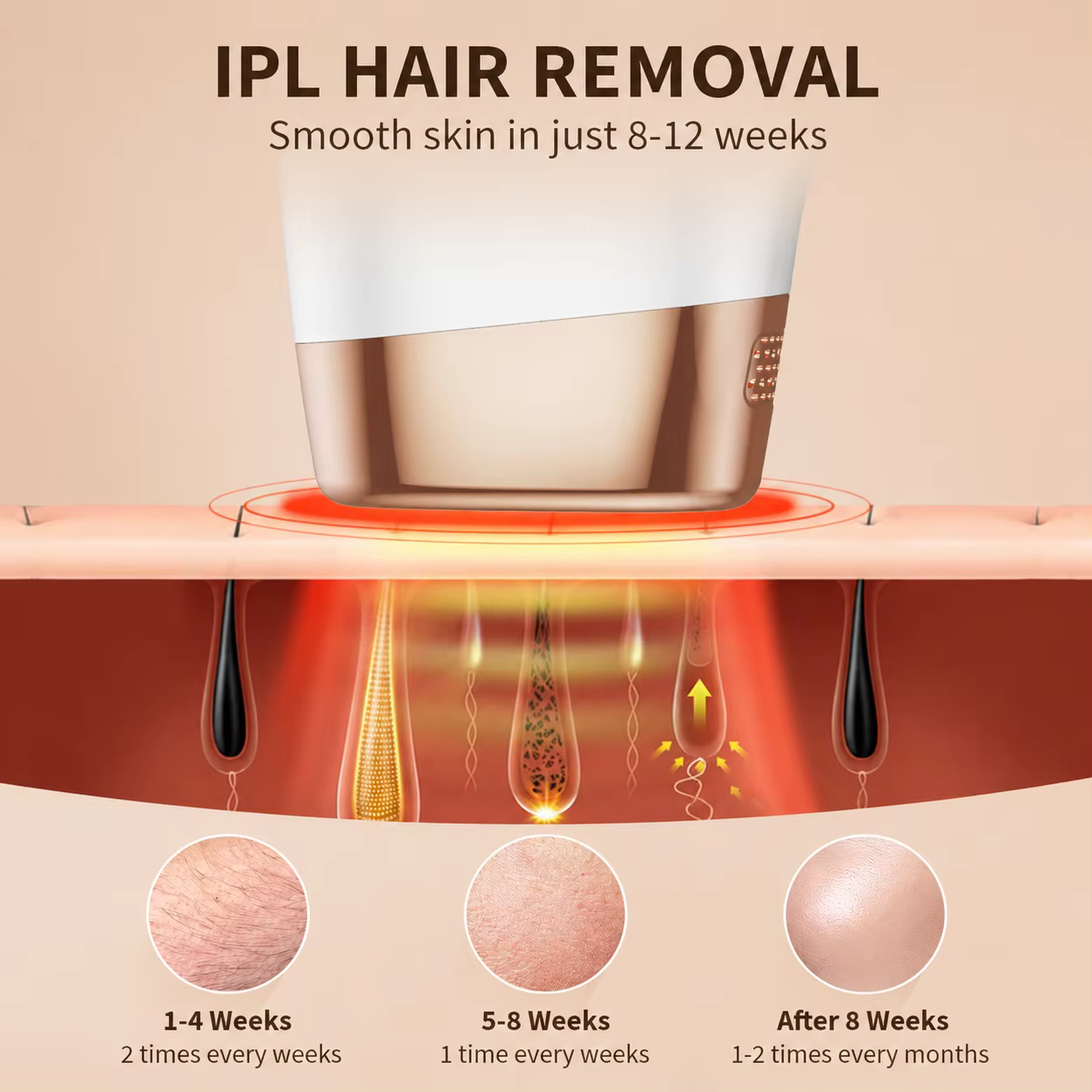 Appareil d'épilation IPL pour femmes et hommes