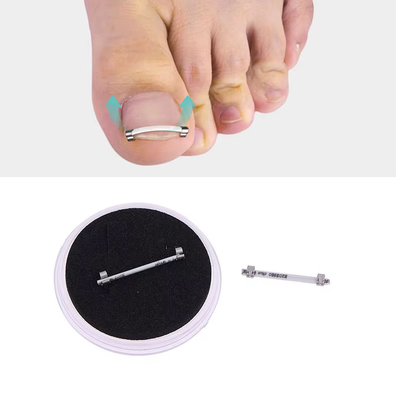 Correcteur d'ongles incarnés pour pédicure
