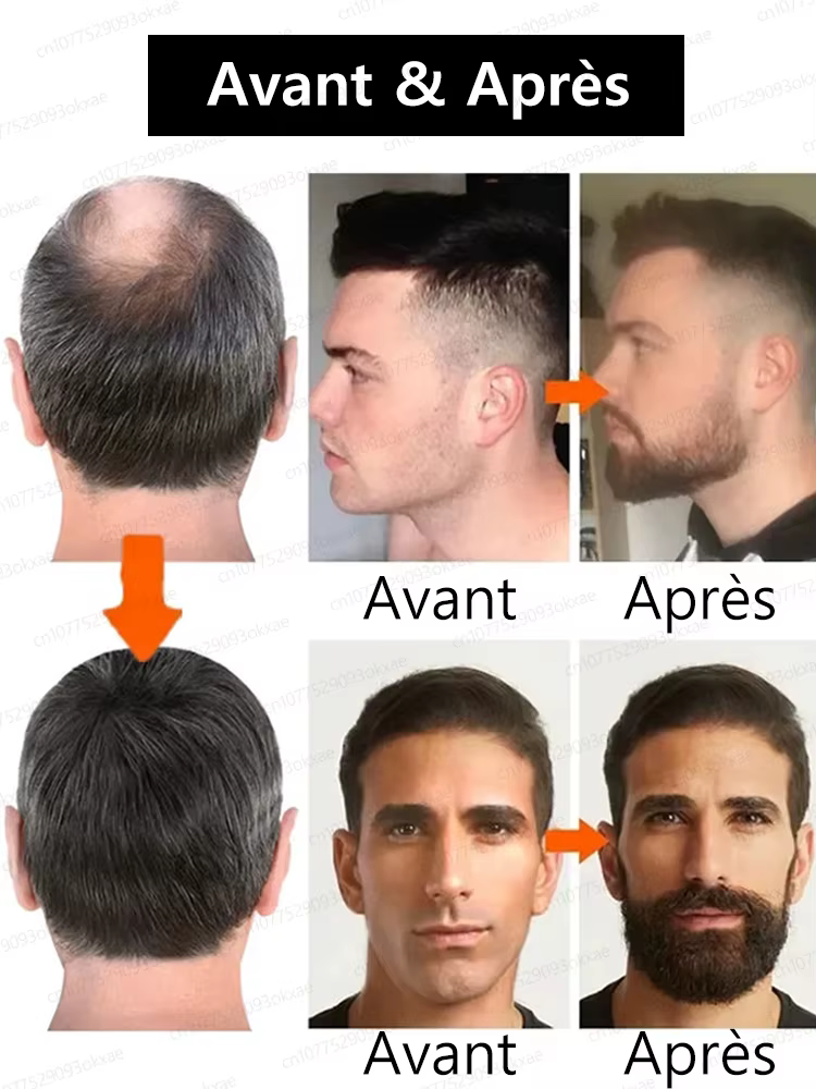 L'essence de croissance de barbe la plus efficace en 2025