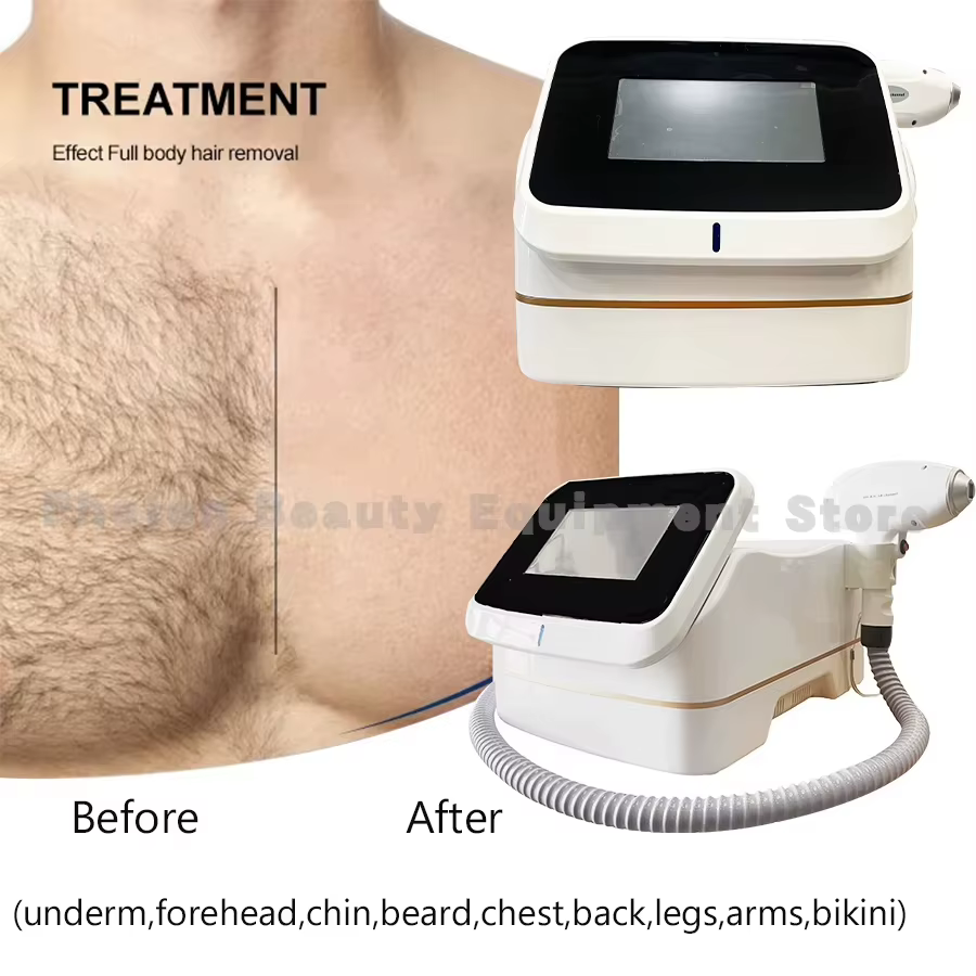 Épilateur laser diode professionnel 3 ondes pour le corps et le visage