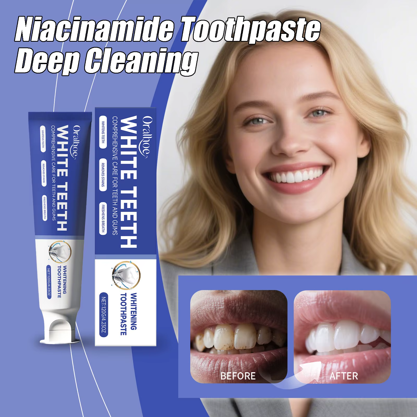 Dentifrice Blanchissant Avancé pour le Nettoyage des Dents, Apaise les Gencives, Haleine Fraîche Efficace, Soin des Gencives