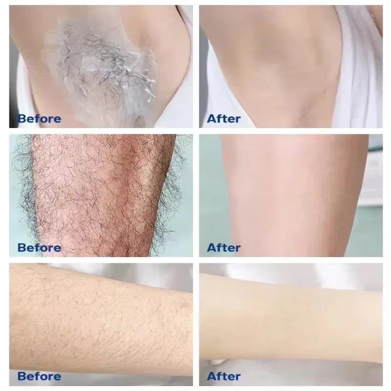 Crème d'épilation rapide indolore inhibiteur de croissance des cheveux bras aisselles jambes dépilatoire Permanent pour hommes femmes beauté soins de santé 60g