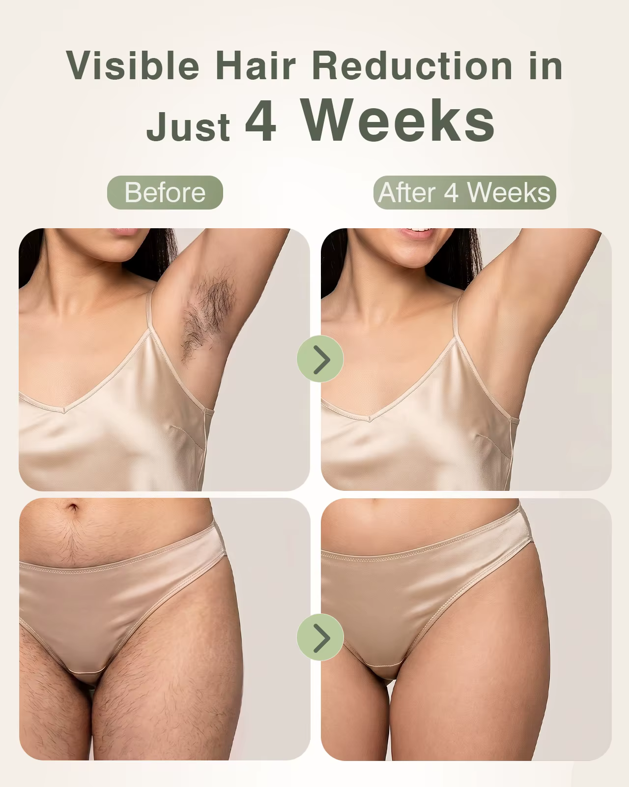 Épilation IPL avec fonction de refroidissement par glace pour femmes