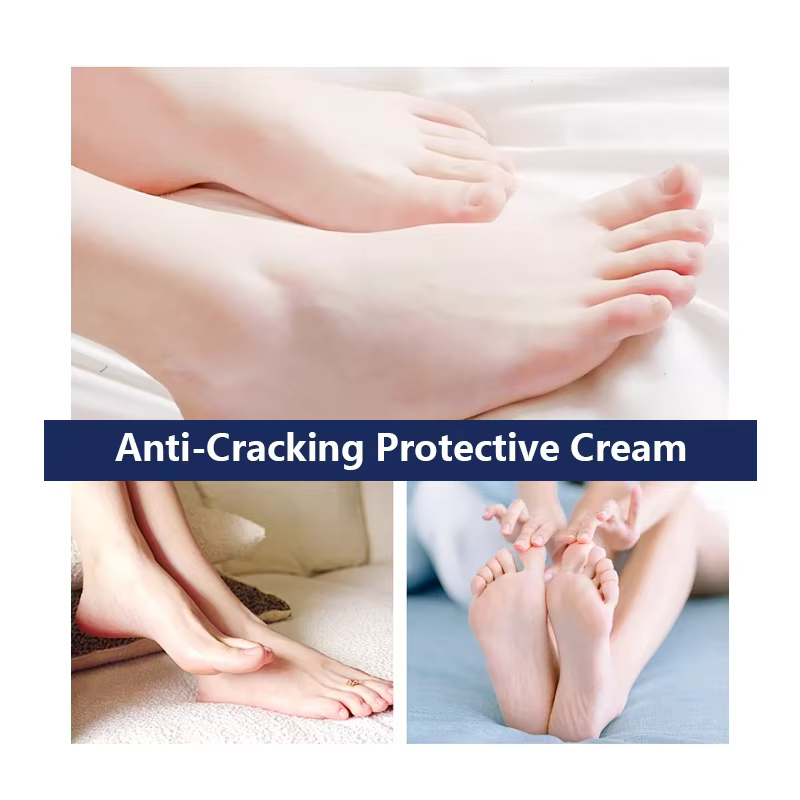 Crème pour les Pieds à 60% d'Urée