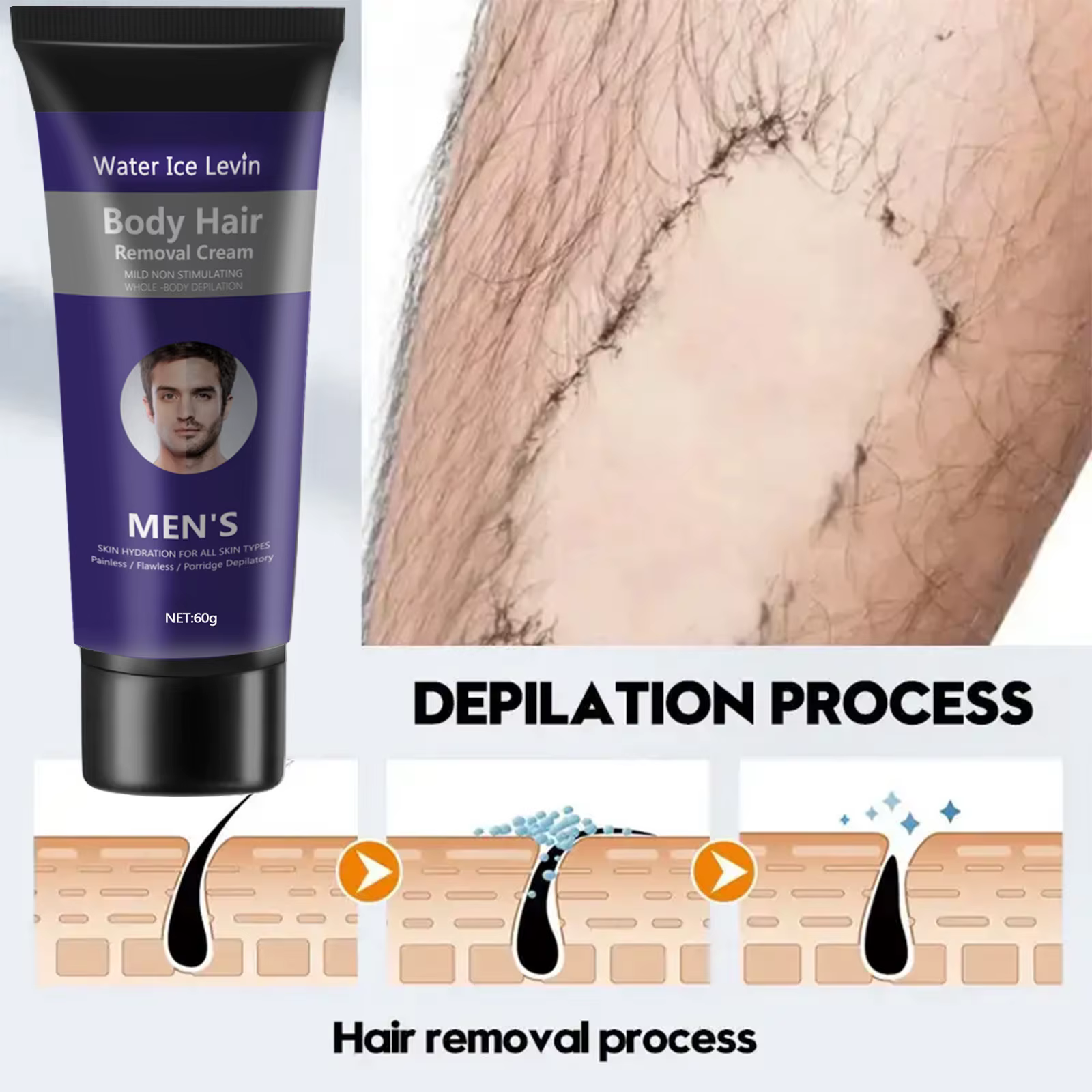 Crème d'épilation permanente épilateur