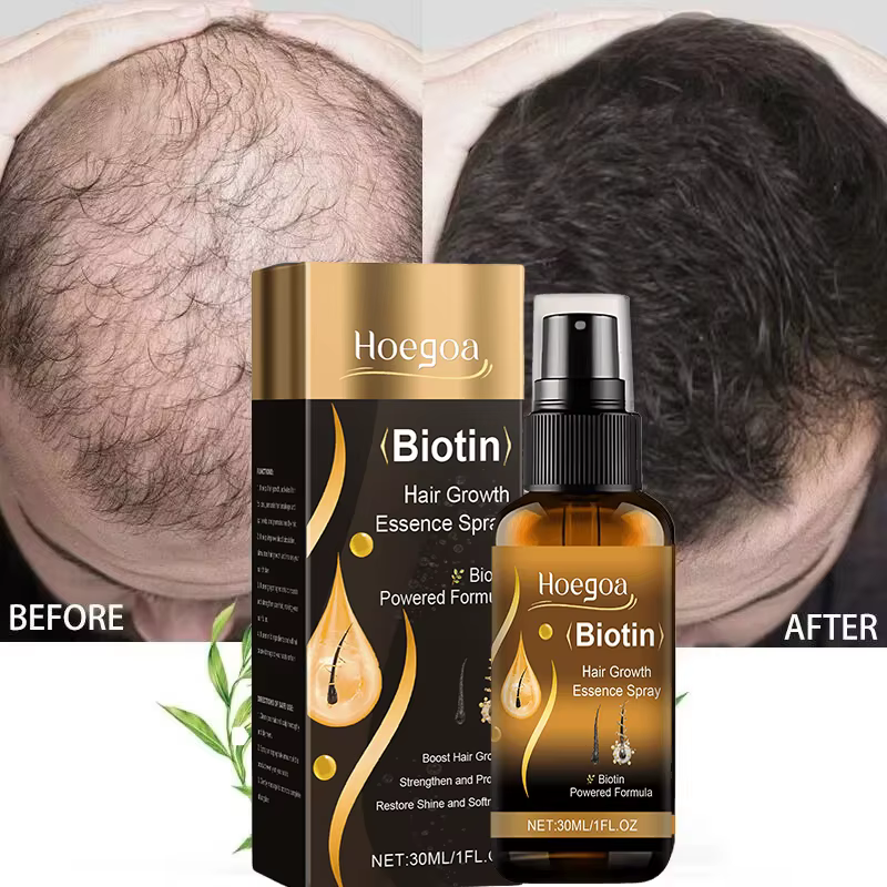 Spray de croissance rapide des cheveux à la biotine