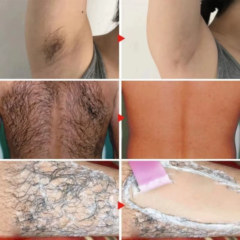 Crème dépilatoire permanente